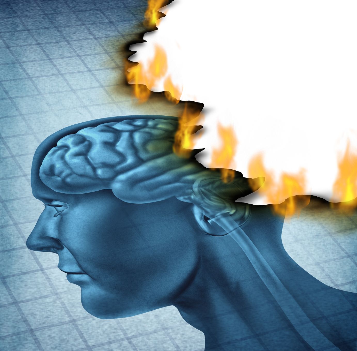 Burnout brain from alzheimers.  https://www.holisticbphealth.com/Brain-Health.html