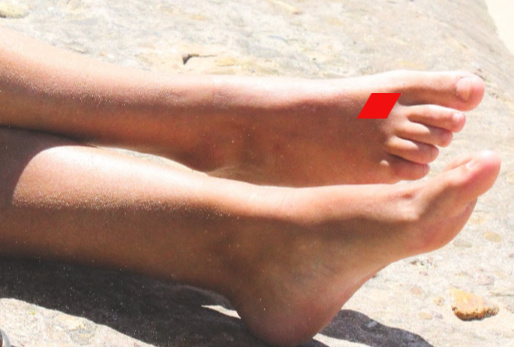 Toes. https://www.info-on-high-blood-pressure.com/Acupressure.html Toes. https://www.info-on-high-blood-pressure.com/Acupressure.html